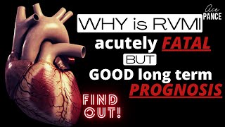 Understand Right Ventricular Myocardial Infarction in 12 mins [upl. by Jedidiah]