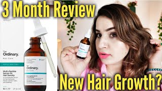 Ordinary Multi Peptide Hair Density Serum review  3 month experience [upl. by Anerhs]