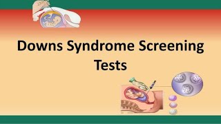 Downs Syndrome Screening Tests [upl. by Silsby79]