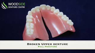 Denture Repair in Airdrie AB  Woodside Denture Centre [upl. by Pappas]