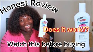 PALMER’S SKIN SUCCESS FADE MILK HONEST REVIEW  WATCH THIS BEFORE BUYING [upl. by Eugenle146]