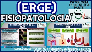 ENFERMEDAD POR REFLUJO GASTROESOFÁGICO FISIOPATOLOGÍA  GuiaMed [upl. by Eynobe]