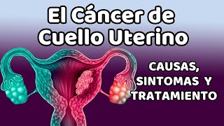 CÁNCER DE CUELLO UTERINO Causas signos y síntomas diagnóstico y tratamiento [upl. by Maure]