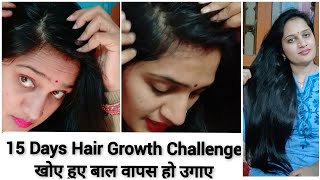 Only 15 Days Hair growth challengeना झड़ेंगे ना टूटेंगे बालों को मोटा व लंबा करने का अचूक उपाय [upl. by Annav939]