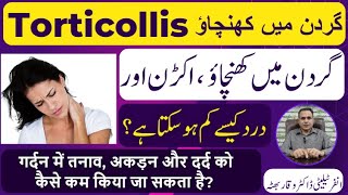 Torticollis گردن میں کھنچاؤ मन्यास्तंभ Homeopathic Treatmennt By Dr Waqar Bhutta In Urdu  Hindi [upl. by Eniad323]