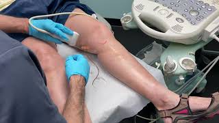 How to treat Varicose Veins easily using the ScleroSafe platform [upl. by Stephania7]