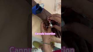 Cannula insertion of old male patient nursescannuladoctorneet mbbsmedicalstudentnursingstuden [upl. by Saduj]