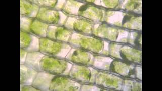 Osmosis in Elodea [upl. by Heydon659]