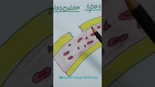 Vascular Spasmshorts1st step in blood clotting [upl. by Etienne]