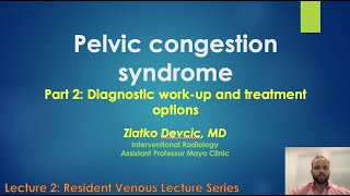 Pelvic Congestion Syndrome Part 2 Diagnostic WorkUp and Treatment Options [upl. by Ruperta139]