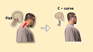 일자목 목 C자 커브 5분만에 바로 잡는 방법 [upl. by Akimihs]