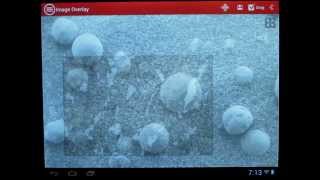 mVision  A Microscopic App for Android [upl. by Akirahc]