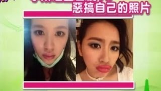 【現在才知道】1403061 微整後嘴唇腫到爆Plastic Surgeries quotKnow Howquot [upl. by Emsmus]