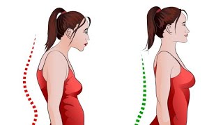 UPPER CROSS SYNDROME physiocell [upl. by Vyner838]