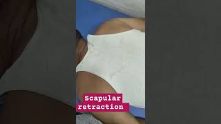 Scapular retraction [upl. by Lynd475]