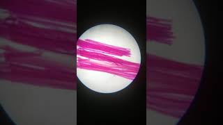 Striated muscle fibres [upl. by Eneiluj]