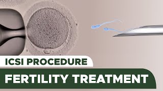 Fertility Treatment Intracytoplasmic Sperm Injection ICSI Procedure [upl. by Amersham922]