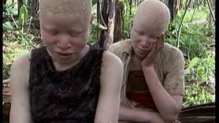 Deadly Hunt Albinos in Tanzania [upl. by Hanad]