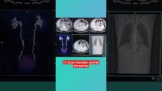 CHECK CT SCAN UROGRAPHY [upl. by Youlton]