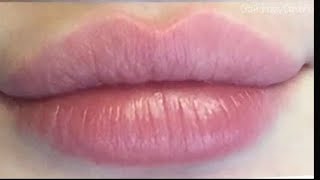 Heart shaped kisses ♡ lip filler procedure lip lift pink rosy color 💉 [upl. by Annahsed]