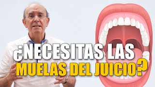 🦷¿Es necesaria la extracción de las muelas del juicio [upl. by Attelrahs]