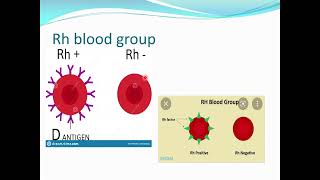 Red cell iso immunisationAlloimmunisationPregnancy in Rh negative women [upl. by Inod]