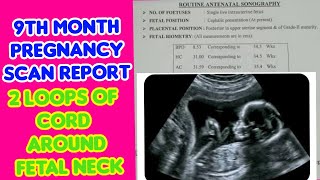 9th month pregnancy scan report in TeluguAntenatal scan report9th month pregnancy scan report [upl. by Oinigih]