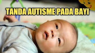 Gejala Autisme Pada Bayi yang Perlu Diwaspadai [upl. by Romelda143]