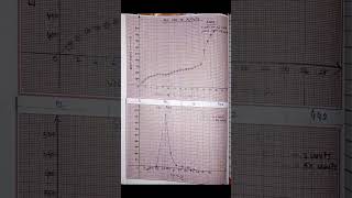 Potentiometric Titration of Fe2 with K2Cr2O7 chemistryexperiments [upl. by Sheila]