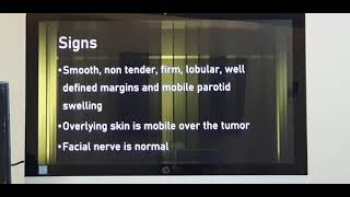 Pleomorphic adenoma Parotid gland Part 1 Patient teaching programme Hindi [upl. by Darees]