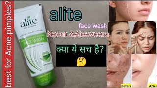 सिर्फ तीन दिन मे करे आपके pimple acne दूर क्या ये सच है alite Face wash for Acne pimples acne [upl. by Khosrow263]