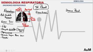 SEMIOLOGIA DEL SÍNDROME PLEURAL [upl. by Jamel259]