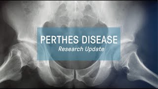 Perthes Disease Research Update  webinar [upl. by Higbee]