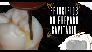 Princípios do Preparo Cavitário [upl. by Fabron]