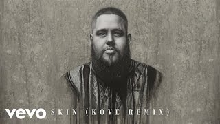 RagnBone Man  Skin Kove Remix Audio [upl. by Roland]