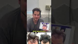 STEM CELL  PRP Therapy for Hair Loss with before and after photos [upl. by Anes]