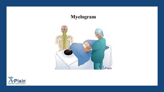 Myelogram [upl. by Reave]