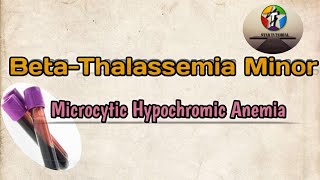 BetaThalassemia Minor ll Microcytic Hypochromic Anemia ll Hematology And Blood Banking [upl. by Waligore]