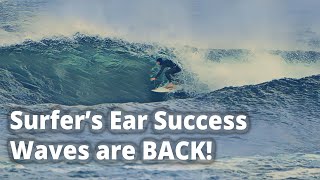 Double Surfers Ear Surgery Success amp Waves are BACK [upl. by Katharyn338]