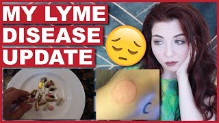 My Lyme Disease Update [upl. by Samson]