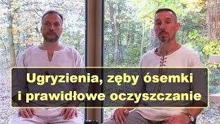 Ugryzienia zęby ósemki i prawidłowe oczyszczanie  prof Siergiej Czarny [upl. by Annam301]