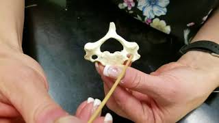 Lab Video Vertebrae [upl. by Kciremed660]