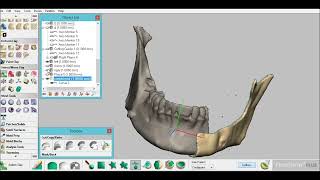 Patientspecific mandible reconstruction implant by Geomagic freeform and haptic device [upl. by Lehmann]