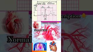 normal🫀ecg🫀heart🫀p QRS t Wave🫀heartattack🫀heart disease🫀viralshorts🫀yt shortsmbbsdoctor [upl. by Yht]