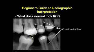 Radiographic Interpretation Section 1 [upl. by Viddah700]