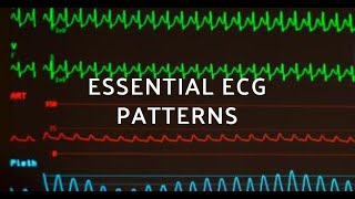 10 ECG Patterns Every Doctor Should Identify  Essential ECG Interpretation Guide [upl. by Ahtera805]