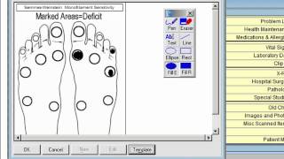 Image Template for SemmesWeinstein monofilament exam [upl. by Akcire436]