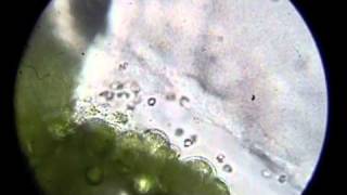 Ceratopteris gametophytes and sperm [upl. by Jermaine833]