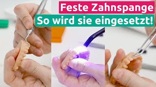 Feste Zahnspange So wird sie in den Mund eingesetzt [upl. by Zetnas888]