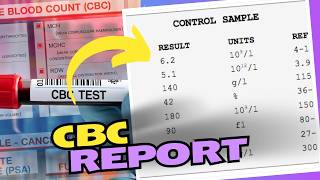 CBC Blood Test Results How to Read and Understand Your Results [upl. by Costanza809]